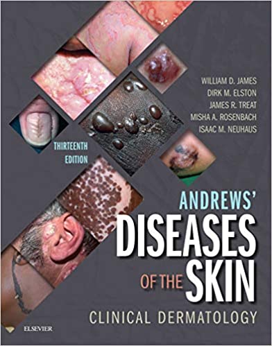 Andrews' Diseases of the Skin: Clinical Dermatology (13th Edition) - Original PDF